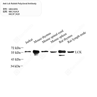 Антитела первичные, поликлональные кролика к Lck крысы, мыши, человека, 50 мкл