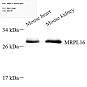 Антитела первичные, поликлональные, MRPL16, 100 мкл