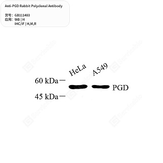 Антитела первичные, поликлональные кролика к PGD крысы, мыши, человека, 50 мкл