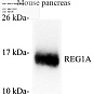 Антитела первичные, поликлональные, REG1A, 100 мкл