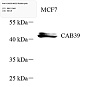 Антитела первичные, поликлональные, CAB39/MO25, 100 мкл