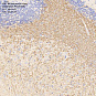 Антитела первичные, моноклональные, Neurofilament heavy polypeptide, 100 мкл