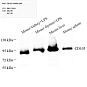 Антитела первичные, поликлональные, CD105, 100 мкл