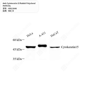 Антитела первичные, поликлональные кролика к Cytokeratin 15 человека, 50 мкл