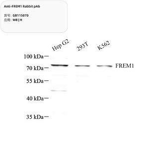 Антитела первичные, поликлональные кролика к FREM1 человека, 100 мкл