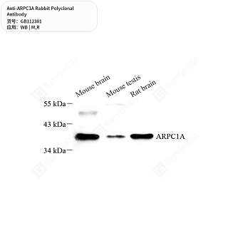 Антитела первичные, поликлональные кролика к ARPC1A крысы, мыши, 50 мкл