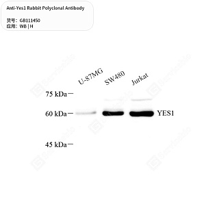 Антитела первичные, поликлональные кролика к Yes1 человека, 50 мкл