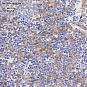 Антитела первичные, поликлональные, P2Y4, 100 мкл