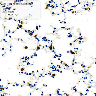 Антитела первичные, поликлональные кролика к Fatty Acid Synthase крысы, мыши, 100 мкл