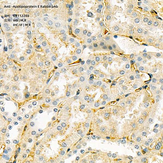 Антитела первичные, поликлональные кролика к Apolipoprotein E крысы, мыши, человека, 100 мкл