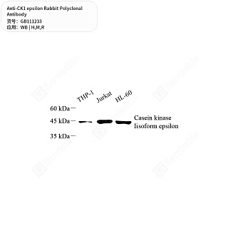 Антитела первичные, поликлональные кролика к CK1 epsilon крысы, мыши, человека, 50 мкл