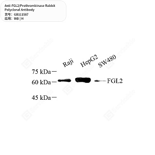 Антитела первичные, поликлональные кролика к FGL2/Prothrombinase человека, 50 мкл