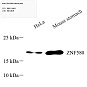 Антитела первичные, поликлональные, ZNF580, 100 мкл