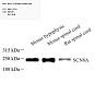 Антитела первичные, поликлональные, Nav1.6/SCN8A, 100 мкл