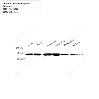 Антитела первичные, поликлональные кролика к DCP1B крысы, мыши, человека, 50 мкл