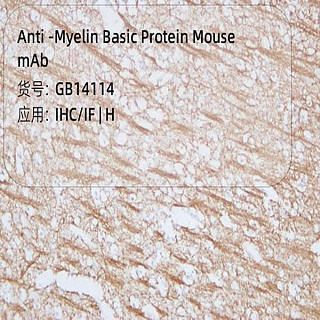 Антитела первичные, моноклональные мыши к Myelin Basic Protein человека, 50 мкл