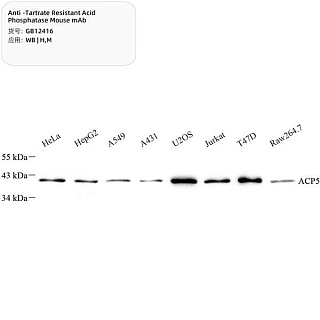 Антитела первич., монокл. мыши к TRAP (Tartrate Resistant Acid Phosphatase) мыши, чел., 100 мкл