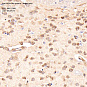 Антитела первичные, поликлональные, PCP4-like protein 1, 100 мкл