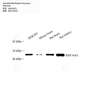 Антитела первичные, поликлональные кролика к RNF144A крысы, мыши, человека, 50 мкл