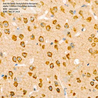 Антитела первичные, поликл. кролика к Nicotinic Acetylcholine Receptor alpha 7 крысы, мыши, 50 мкл