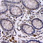 Антитела первичные, поликлональные, BRCA1, 100 мкл
