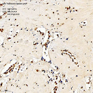 Антитела первичные, поликлональные кролика к Nucleolin крысы, мыши, человека, 100 мкл