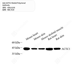Антитела первичные, поликлональные кролика к ACTC1 крысы, мыши, 50 мкл