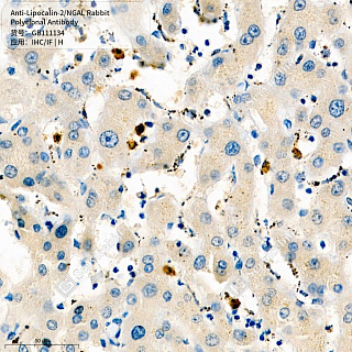 Антитела первичные, поликлональные кролика к Lipocalin-2/NGAL человека, 50 мкл