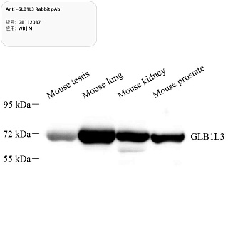 Антитела первичные, поликлональные кролика к GLB1L3 мыши, 100 мкл