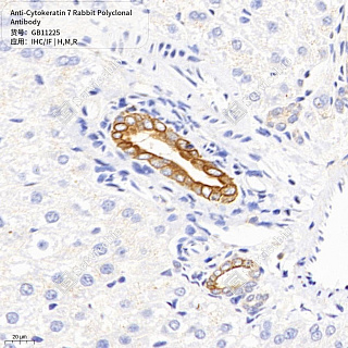 Антитела первичные, поликлональные кролика к Cytokeratin 7 крысы, мыши, человека, 50 мкл