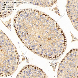Антитела первичные, поликлональные кролика к ATPase MORC2 крысы, мыши, 50 мкл
