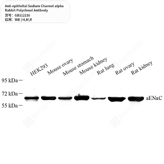 Антитела первичные, поликл. кролика к epithelial Sodium Channel alpha крысы, мыши, человека, 50 мкл