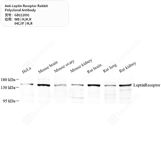 Антитела первичные, поликлональные кролика к Leptin Receptor крысы, мыши, человека, 50 мкл