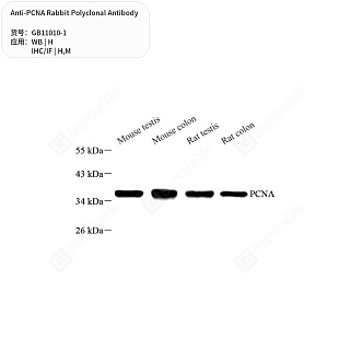 Антитела первичные, поликлональные кролика к PCNA мыши, человека, 50 мкл