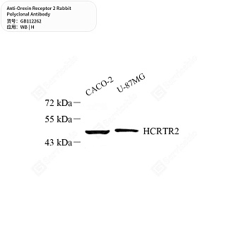Антитела первичные, поликлональные кролика к Orexin Receptor 2 человека, 50 мкл