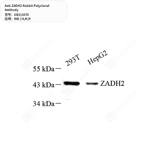 Антитела первичные, поликлональные кролика к ZADH2 крысы, мыши, человека, 50 мкл