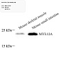 Антитела первичные, поликлональные, MYL12A, 100 мкл