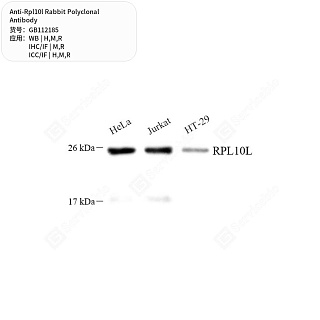 Антитела первичные, поликлональные кролика к Rpl10l крысы, мыши, человека, 50 мкл