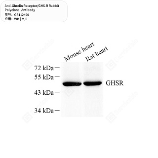 Антитела первичные, поликлональные кролика к Ghrelin Receptor/GHS-R крысы, мыши, 50 мкл