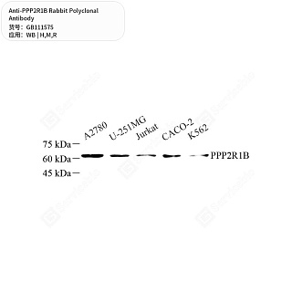 Антитела первичные, поликлональные кролика к PPP2R1B крысы, мыши, человека, 50 мкл