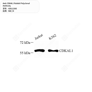 Антитела первичные, поликлональные кролика к CDKAL1 человека, 50 мкл