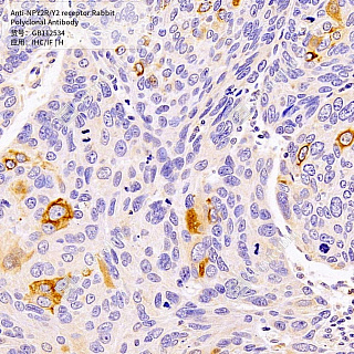 Антитела первичные, поликлональные кролика к NPY2R/Y2 receptor человека, 50 мкл