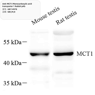 Антитела первичные, поликл. кролика к MCT1/Monocarboxylic acid transporter 1 крысы, мыши, 100 мкл