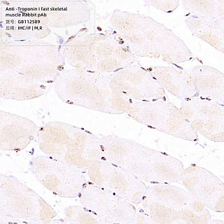 Антитела первичные, поликлональные кролика к Troponin I fast skeletal muscle крысы, мыши, 100 мкл