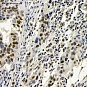 Антитела первичные, поликлональные, BRCA1, 100 мкл