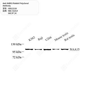 Антитела первичные, поликлональные кролика к NARG1 крысы, мыши, человека, 50 мкл