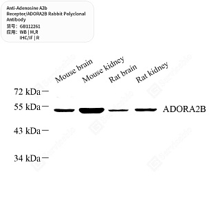 Антитела первичные, поликлональные кролика к Adenosine A2b Receptor/ADORA2B крысы, мыши, 50 мкл