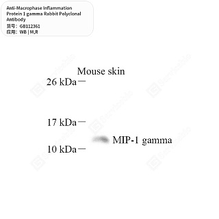 Антитела первичные, поликл. кролика к Macrophase Inflammation Protein 1 gamma крысы, мыши, 50 мкл