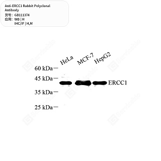 Антитела первичные, поликлональные кролика к ERCC1 мыши, человека, 50 мкл