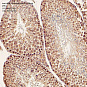 Антитела первичные, поликлональные, IRAK1-binding protein 1, 100 мкл